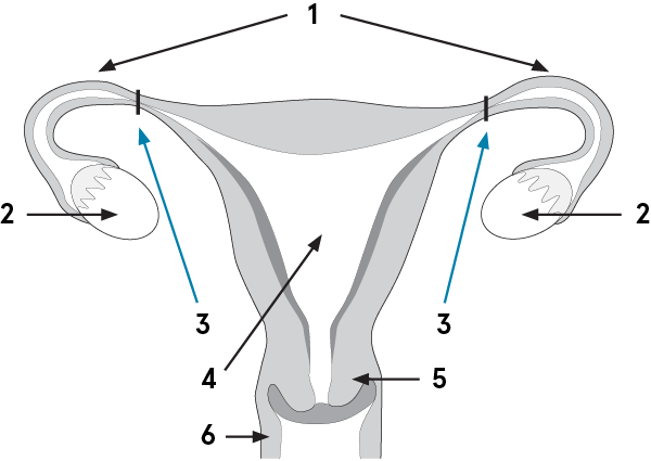 Tubal ligation diagram