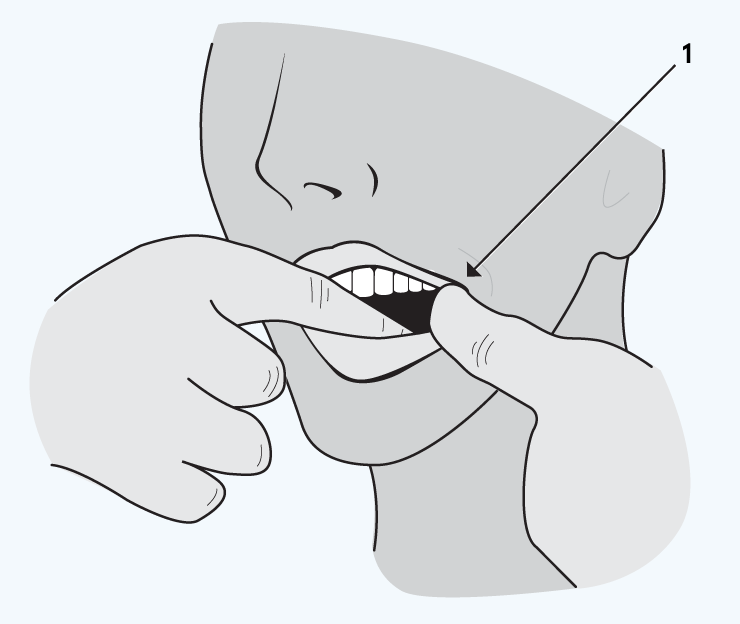 Tablets are absorbed through your cheek illustration