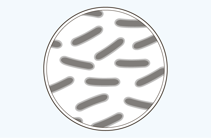 Infection illustration